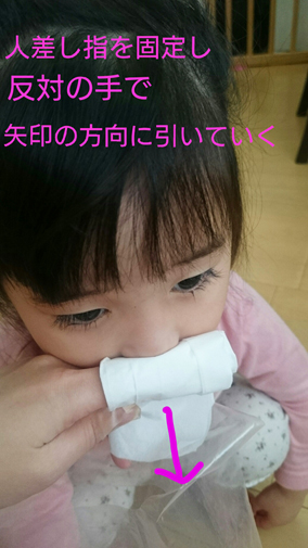 子どもの鼻水トラブル！上手な拭きとり方と鼻下のかぶれの対処法の画像2