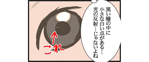 赤ちゃんの眼 大丈夫 娘に発覚したのは 先天性の眼の病気 でした Conobie コノビー