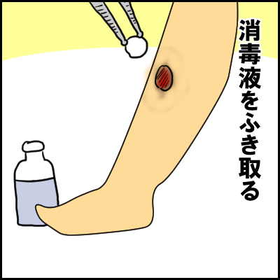 単なる水いぼかと思ったら、高熱が出て入院！？夏の感染症にも気が抜けなかった！の画像12