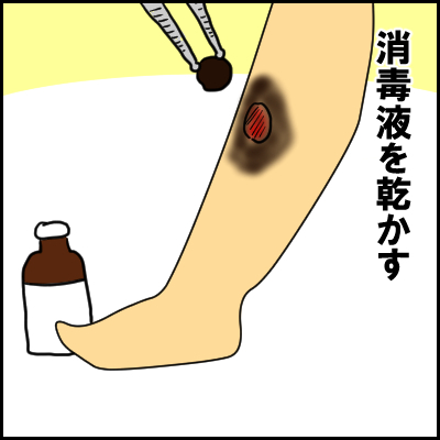 単なる水いぼかと思ったら、高熱が出て入院！？夏の感染症にも気が抜けなかった！の画像11