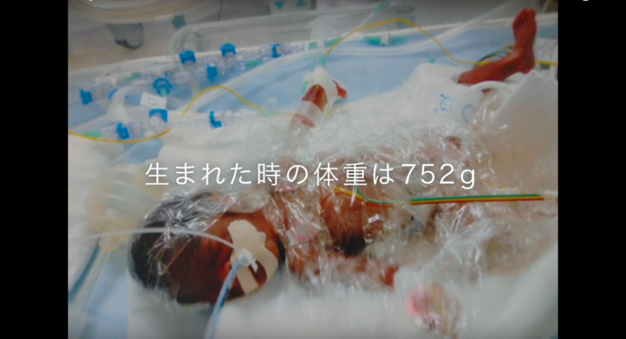752gで生まれた赤ちゃんが、元気に退院するまでの軌跡に涙がとまらない…！の画像1