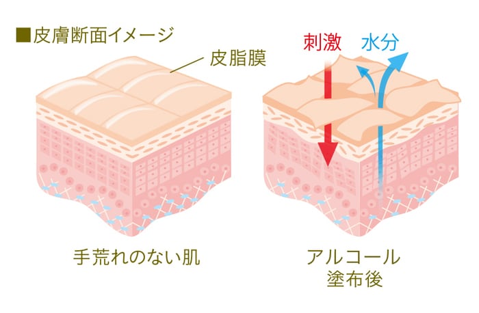 手の乾燥は「アレ」が原因だった！やさしく子どもに触れるためにママができること。の画像3