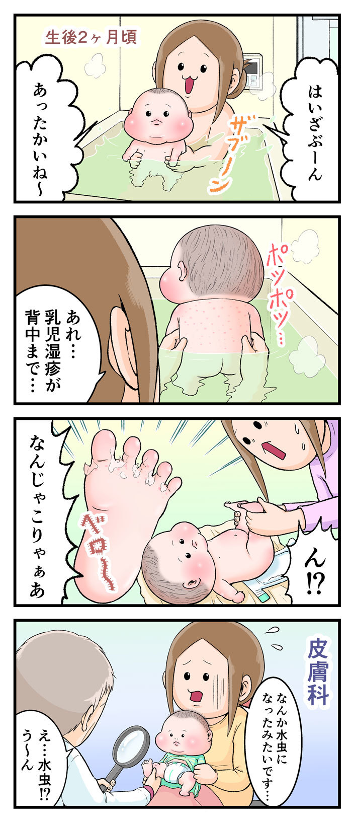 なにこれ水虫！？生後2か月の息子をおそった謎の症状の画像1