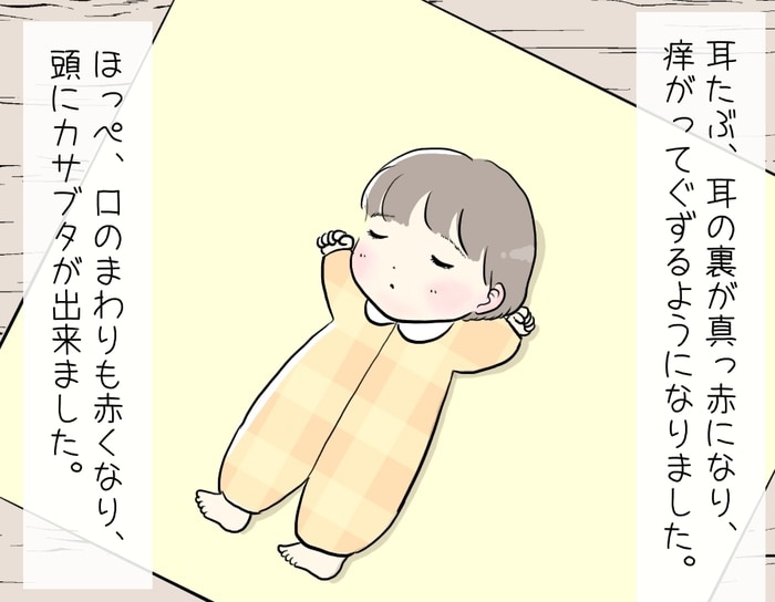 愛しいわが子の、お肌トラブル…。落ち込む日々を、夫が照らす。＜第四回投稿コンテストNO.９２＞の画像7